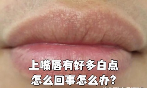 月经期间禁止吃的东西吗网 - 月经期喝冰的会怎样,脸上长黄褐斑看什么科